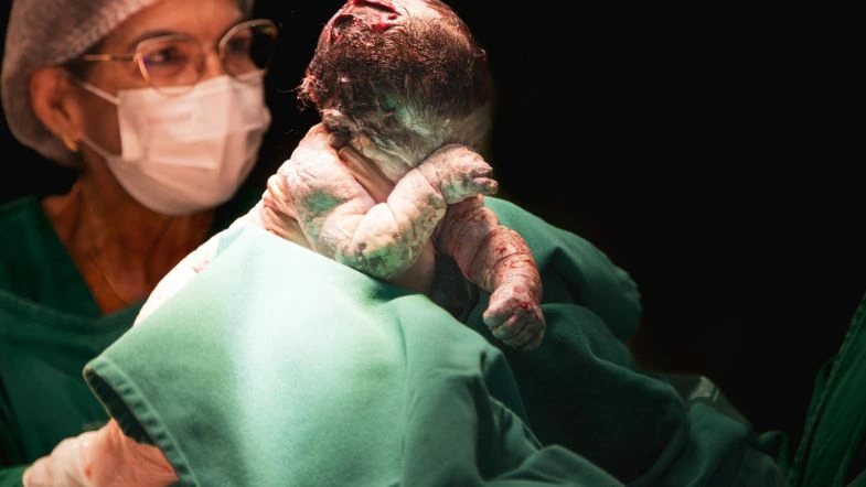 Enfermagem Obstétrica: o enfermeiro e a humanização do parto 6 Profissional da saúde segura um recém-nascido instantes após o parto, representando o momento do nascimento com foco no cuidado humanizado da Enfermagem Obstétrica.