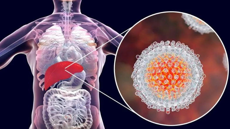 Formação profissional no combate às hepatites virais: por que é essencial? 6 Ilustração anatômica do corpo humano destacando o fígado com um close-up do vírus da hepatite, representando a infecção viral hepática.