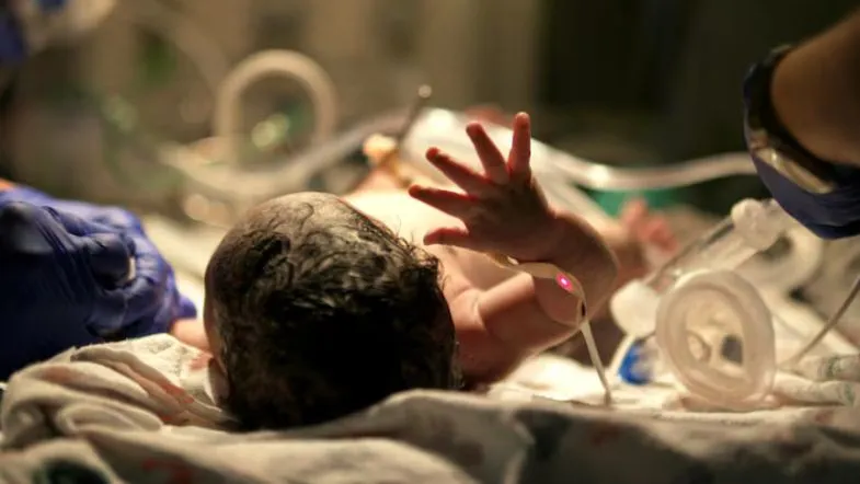 Carreira na UTI Neonatal em 2025: remuneração, oportunidades e o papel da pós-graduação 9 Recém-nascido recebendo cuidados intensivos com suporte de equipamentos e monitorização contínua.